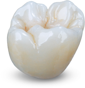 BruxZir Solid Zirconia